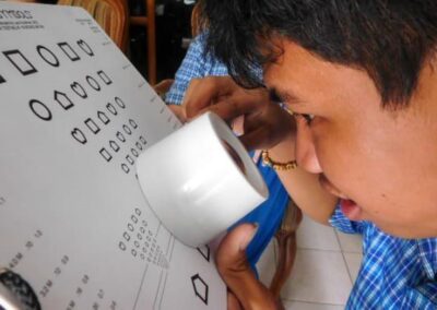 Cambodian child with magnifier taking a low vision assessment